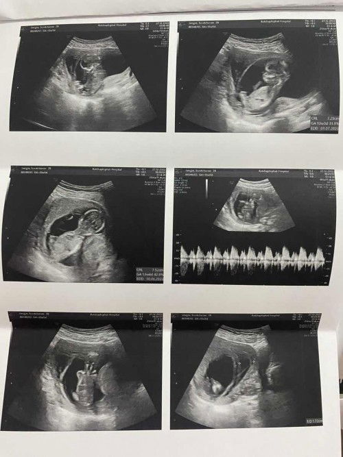 สอบถามแม่ๆในกลุ่ม