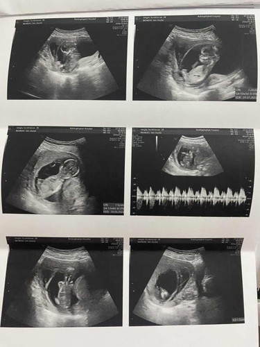 สอบถามแม่ๆในกลุ่ม