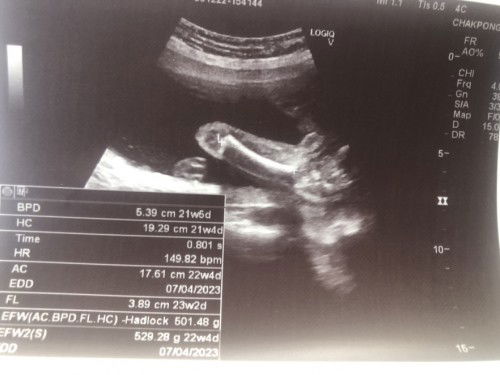 แม่ๆคิดว่าผญ.หรือผช.คะ