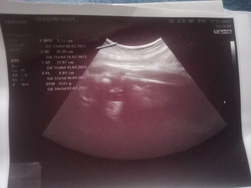 #ท้องแรกค่ะ ขอถามแม่ๆหน่อยค่ะว่าแบบนี้หญิงรึชายจะ9เดือนแล้วยังไม่เห็นเพศเลย #ขอบคุณล่วงหน้านะคะ