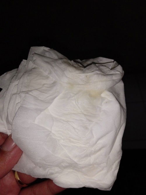 Lendir campur keputihan