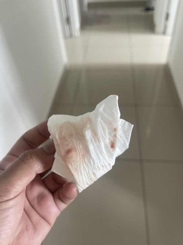 Tanda atau keputihan
