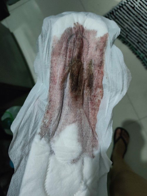 3 months buntis pero parang niregla?