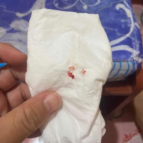 ท้องแรกคะ ขอคำแนะนำหน่อยคะ