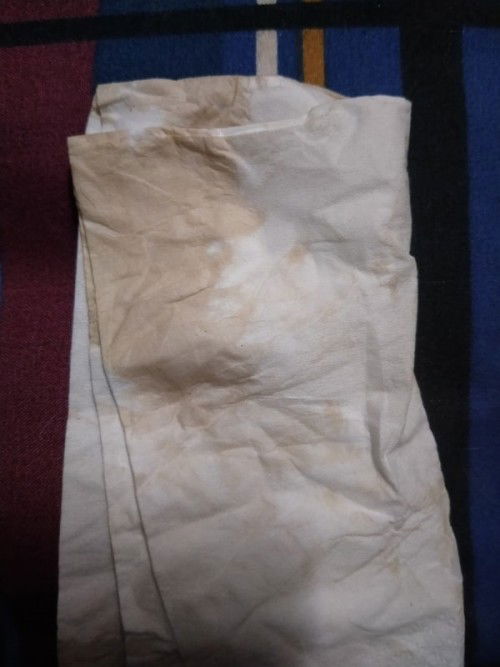 ขอสอบถามแม่ๆค่ะ อายุครรภ์ 38+1 มีน้ำออกมาแบบนี้ ใกล้คลอดหรือป่าวค่ะ