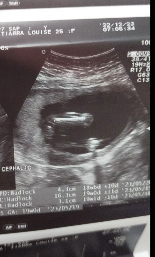 Ano po kaya sa tingin nyo ang gender?