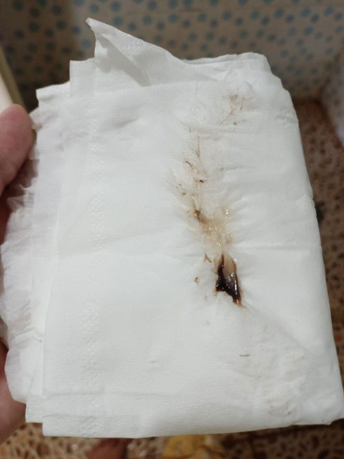 สอบถามแม่ๆหน่อยค่ะ