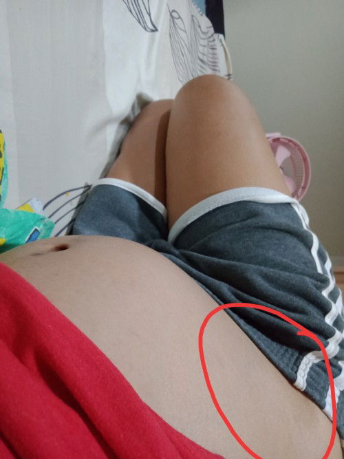 27w เจ็บท้องน้อยแปล๊บๆ