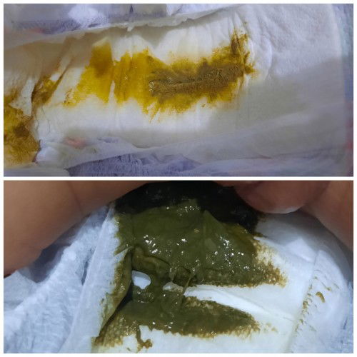Greeny poop (1mo and 18 days old)