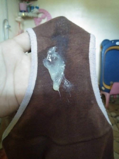 Discharge (Pasintabi po sa larawan)