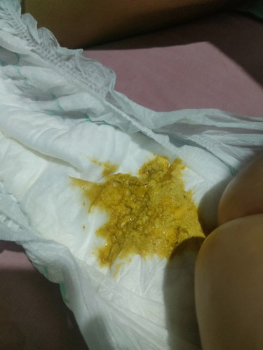 Ask ko lang Po kung normal Po tong poop Ng baby ko Formula fed Po sya