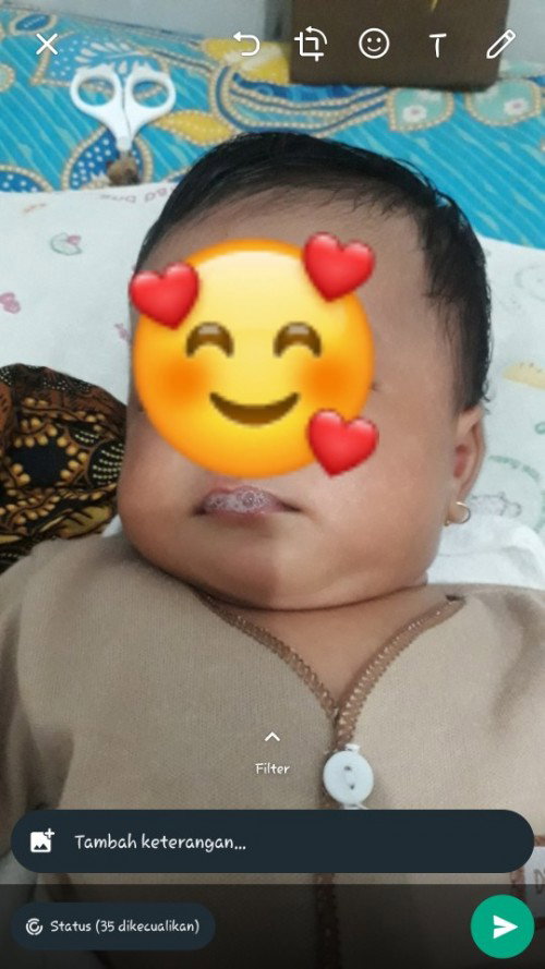 Baby batuk batuk