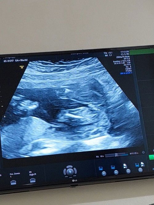 19wซาวน์เพศพึ่งจะเห็นค่ะ บ้านอื่นเห็นกันเกือบหมดแล้ว