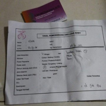 Hasil USG nya ada keterangan kista