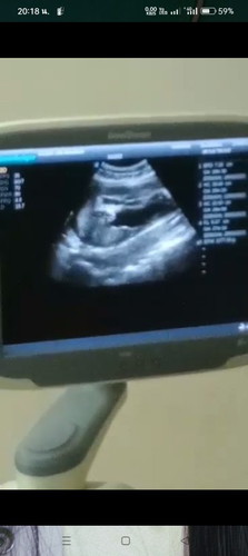 ช่วยดูเพศน้องให้หน่อยค่ะว่าแบบนี้หญิงหรือชาย