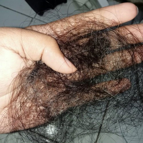 rambut rontok