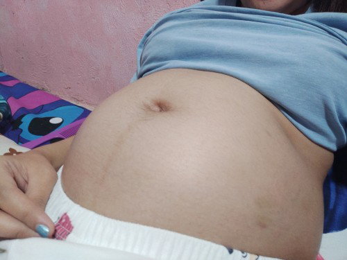 Super Blessed!🥰👶 After 2 Mc's Finally! 
meron na kaming Baby boy😍 
#ApasBaby
#PcosBaby