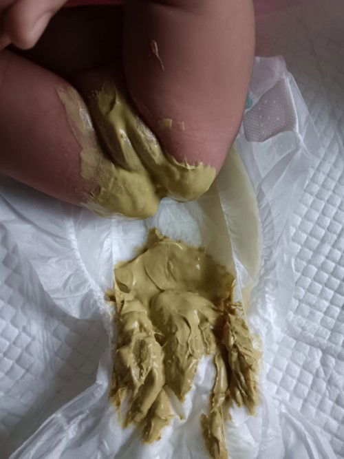 อึสีเขียวเหลว ปกติไหมค่ะ