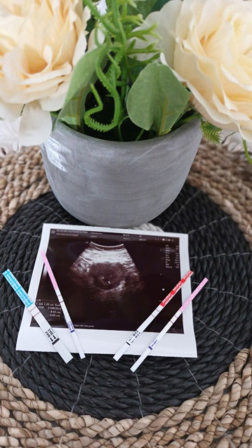 6 minggu usia kehamilan tapi belum terlihat janinnya