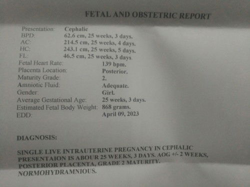 Baka pwede po paki basa