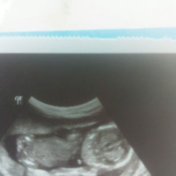 ขอถามแม่ๆหน่อยค่ะแบบนี้ผู้หญิงหรือผู้ชายค่ะ