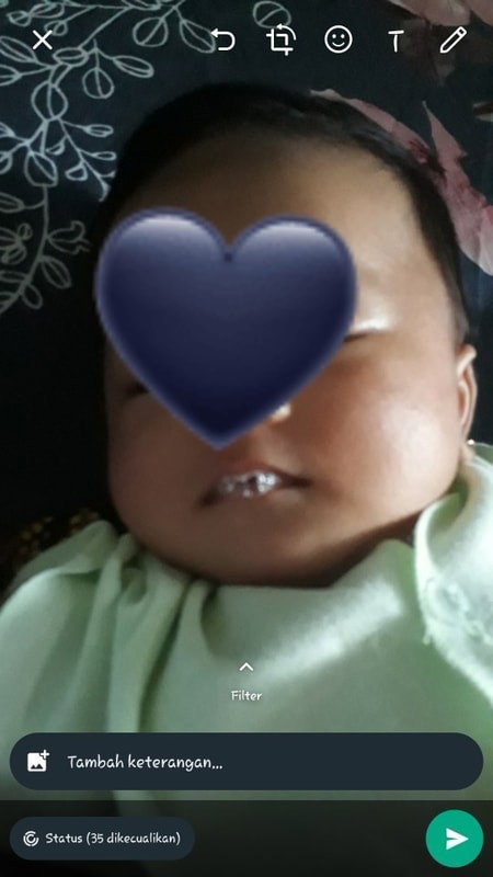Batuk Baby