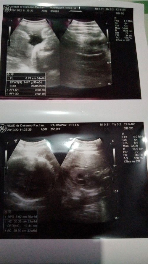 Mohon penjelasannya bunda2 yg baik