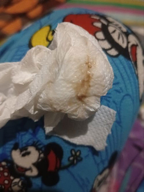 Hello po pasintabi Po pwede Po bang mag tanong anong ibig sabihin nito first time mom Po thank you