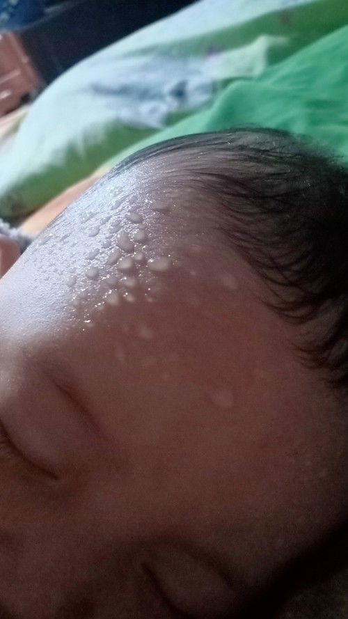 Keringat di kepala bayi
