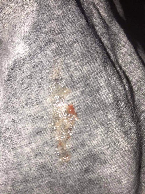 35วีค6วัน