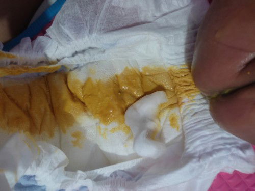 Mixfeed - Breastfeed and Formula Milk - S26 Gold