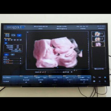 USG tampilan seperti ini apa apakah sudah jelas dan pasti jenis kelamin nya ya bun