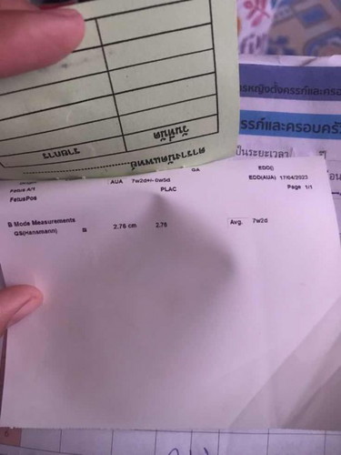 มีแม่ๆคนไหนได้ใบซาวแบบนี้ไหมค่ะ
หมอให้ใบซาวมา แต่ไม่มีรูปขึ้นให้ที่ใบ