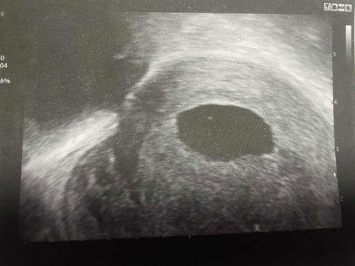 สุดท้ายก็ไม่ได้เจอเจ้าตัวเล็กค่ะ