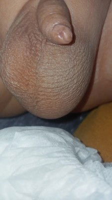 Buah zakar besar sebelah