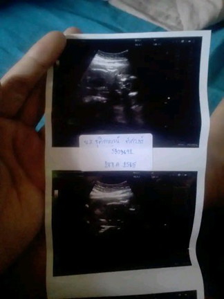 เตรียมของไปคลอด