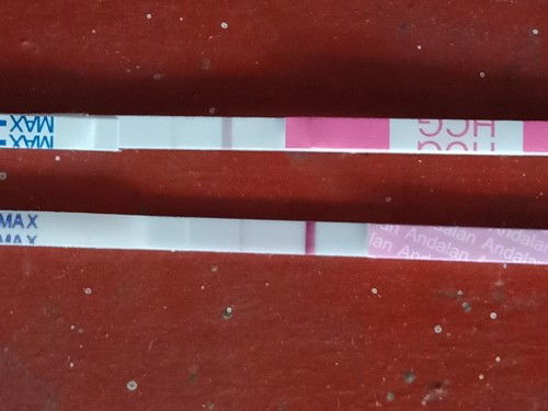 Pengalaman kehamilan