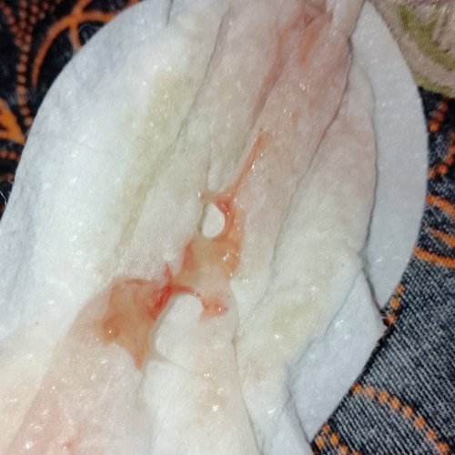 mucus plug po ba ito?