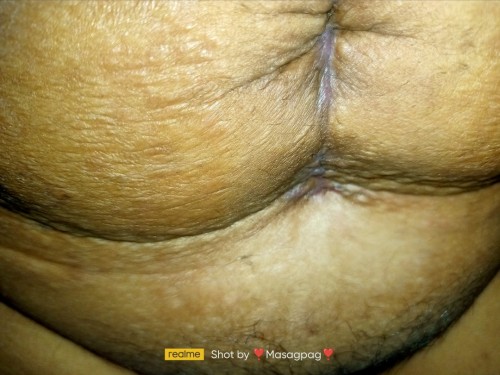 Cs tahi
1month and 2weeks