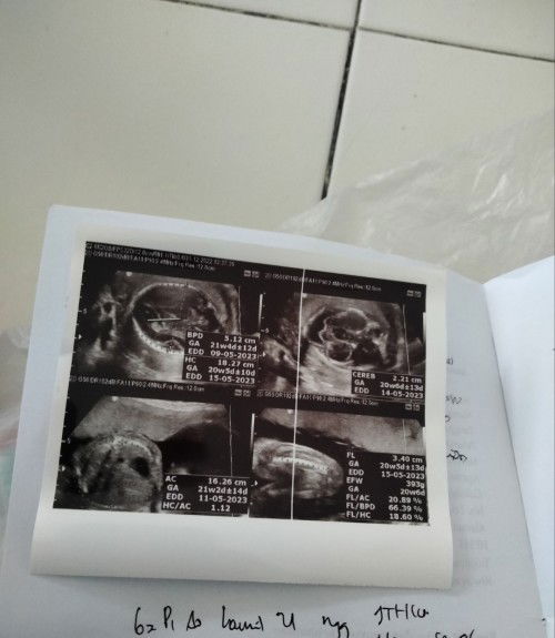 Bunda ini usg 4d apa bkan ya ,