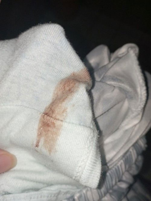 Brown Discharge. Pareply po