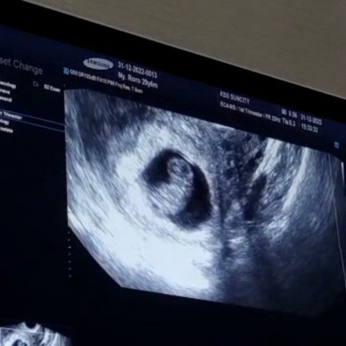 Periksa kehamilan di 8w 6d