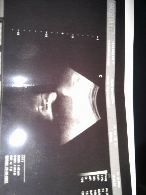 Hamil atau tidak bingung hasil tespek negatif terus