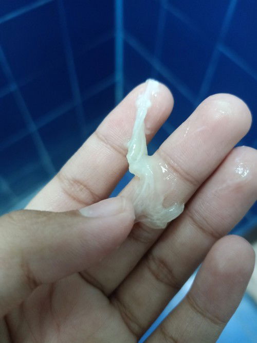 แบบนี้เรียกมูกไหมคะ