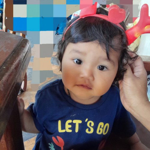 ลูกตาเหล่ ต้องหาหมอไหมคะ