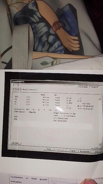 ขอสอบถามหน่อยค่ะ พอดีไปซาวมาแล้วคุณหมอให้แต่ใบนี้มาค่ะไม่มีรูป พอดีท้องแรกด้วยค่ะ