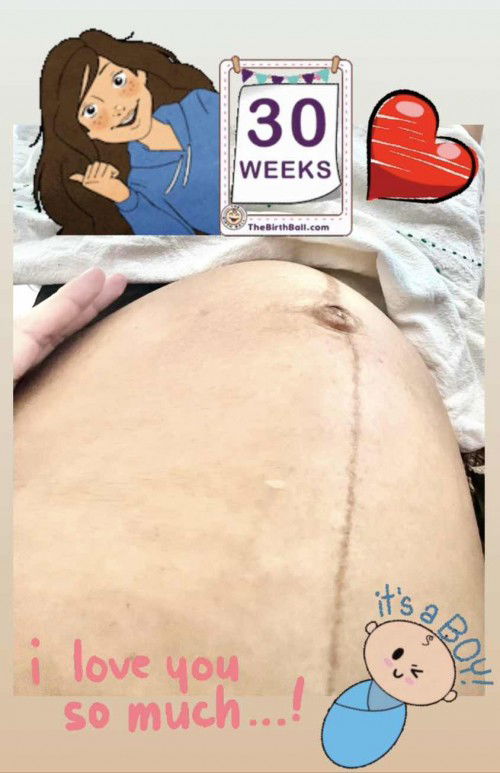 มีแม่ๆท่านไหนเส้นหน้าท้องชัดมาก สะดือปูดและดำ แบบเราบ้างคะ