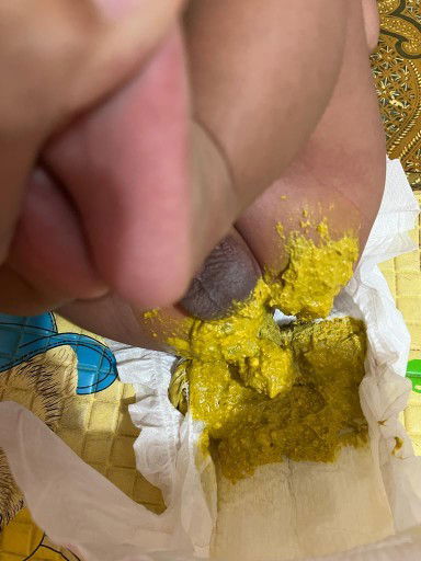 Warna dan tekstur feses bayi berubah semenjak konsumsi sufor