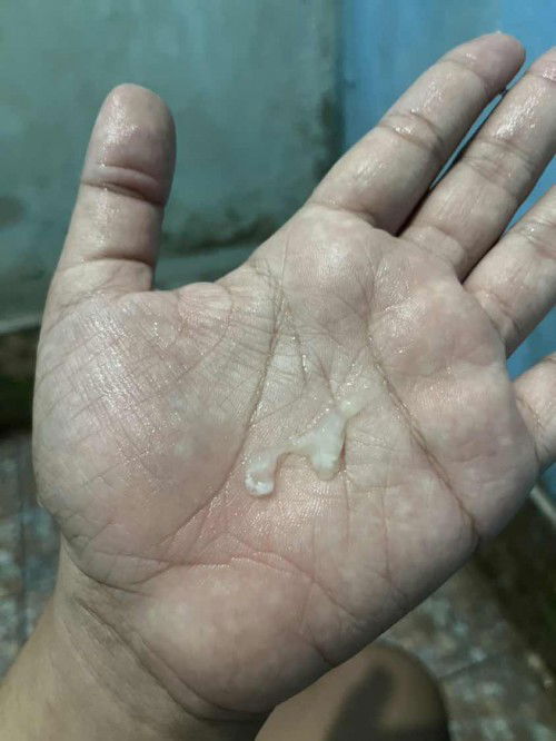 38+6   ท้องเเข็งมา2-3 วันเเล้วค่ะ เเต่ไม่เจ็บไม่ปวด