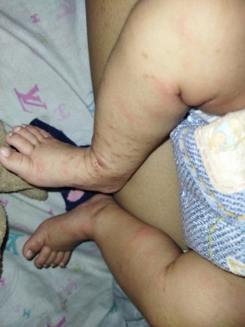 Hi mga mi Ask ko lng po kung ano po kaya etong Asa paa ng anak ko salamat po